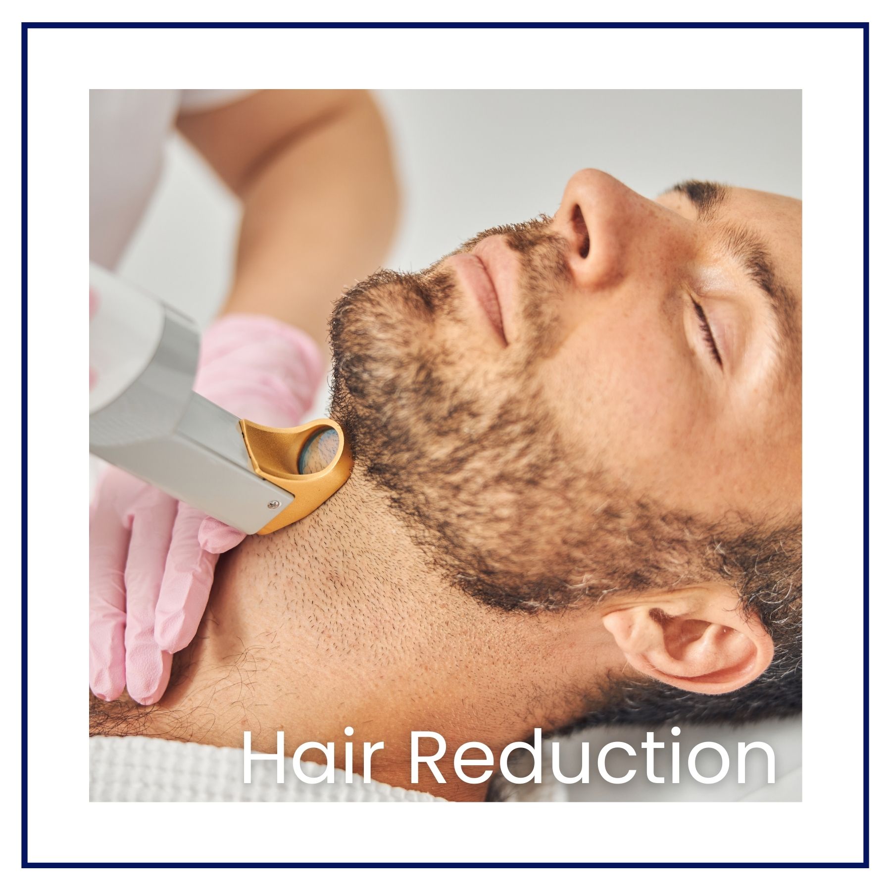 laser hair reduction