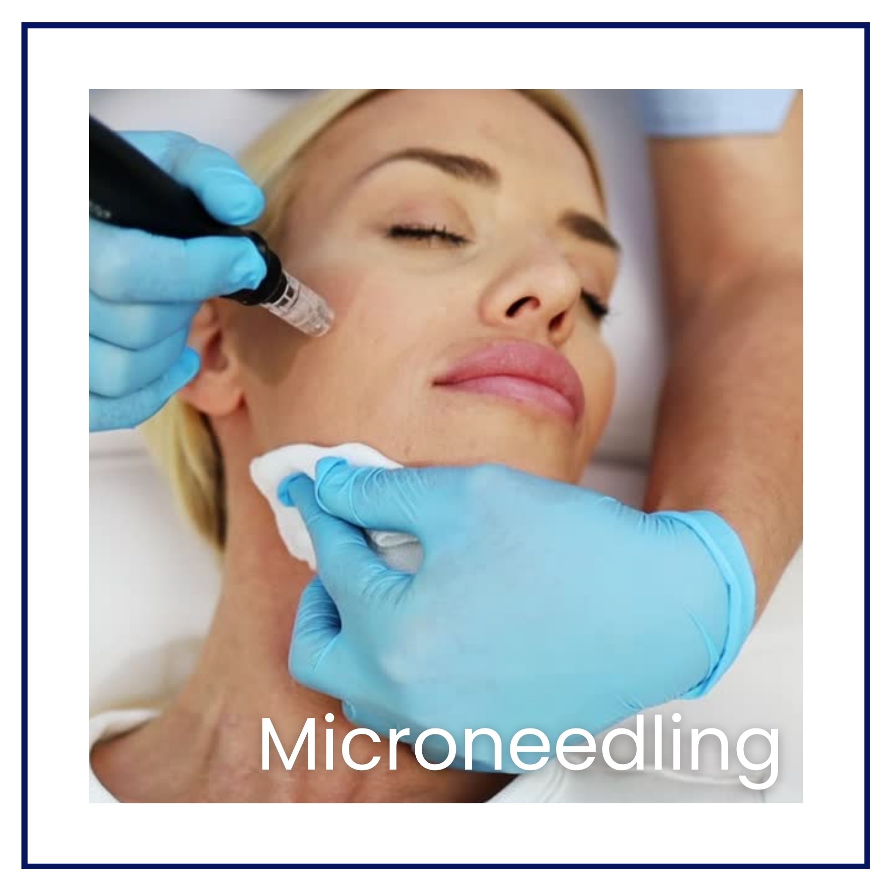 microneedling vid