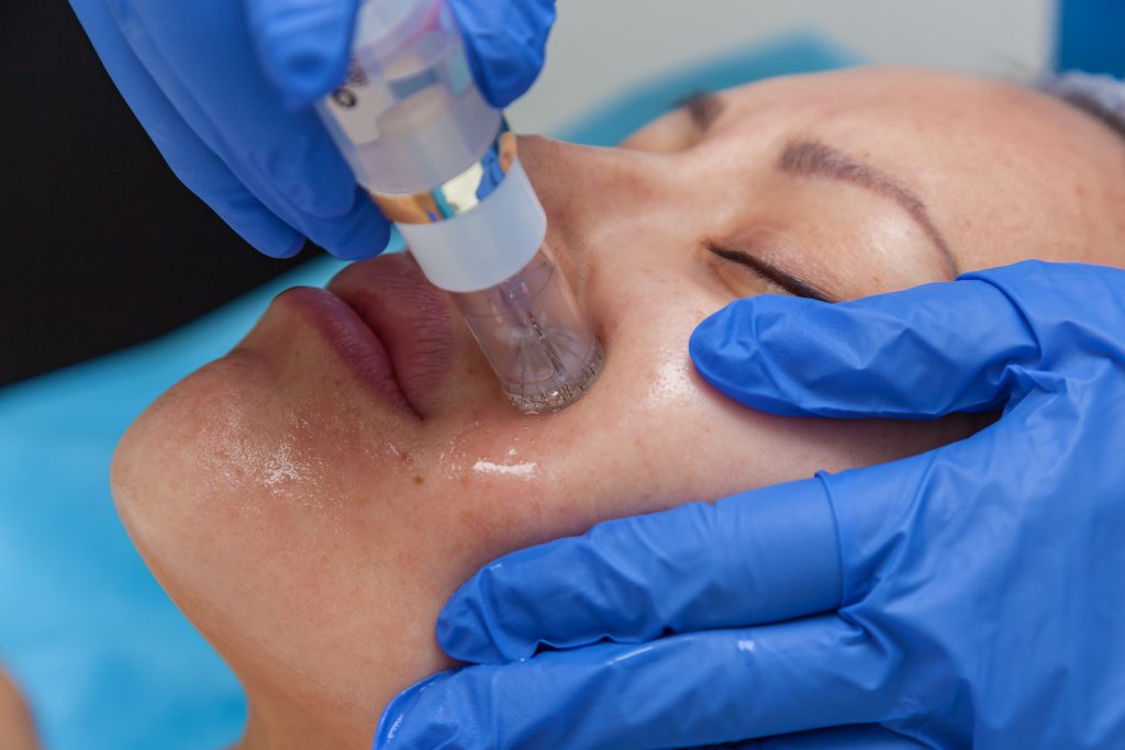 glass facial